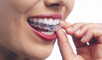 the risks of DIY dentistry