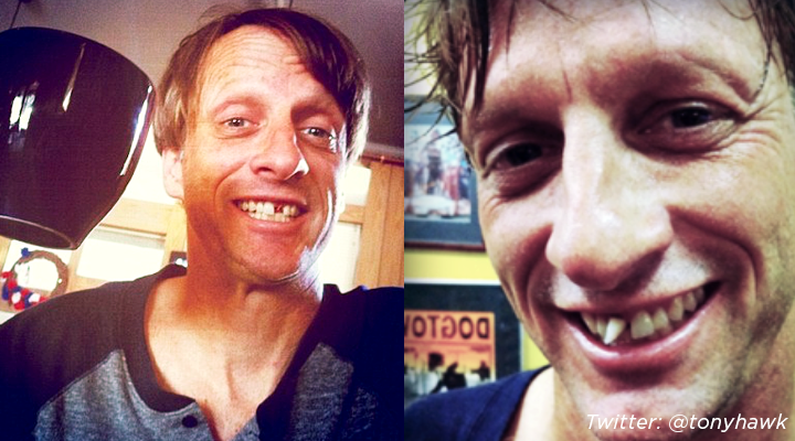 Pro skater Tony Hawk flashes a crooked smile on his @tonyhawk Instagram in 2011.