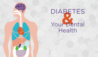 Because individuals diagnosed with diabetes have high blood sugar levels, they often have problems with their teeth and gums, making dental care for diabetics a critical part of care.