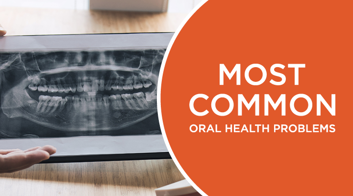 Learn about some of the most common oral health problems people have and ways to prevent them.